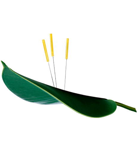 Acupuncture Services