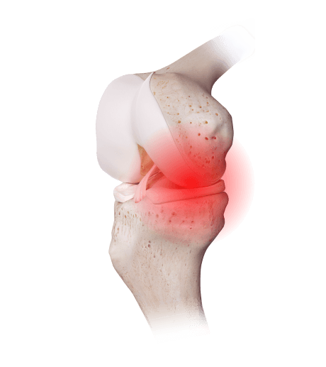 Physical Therapy Services